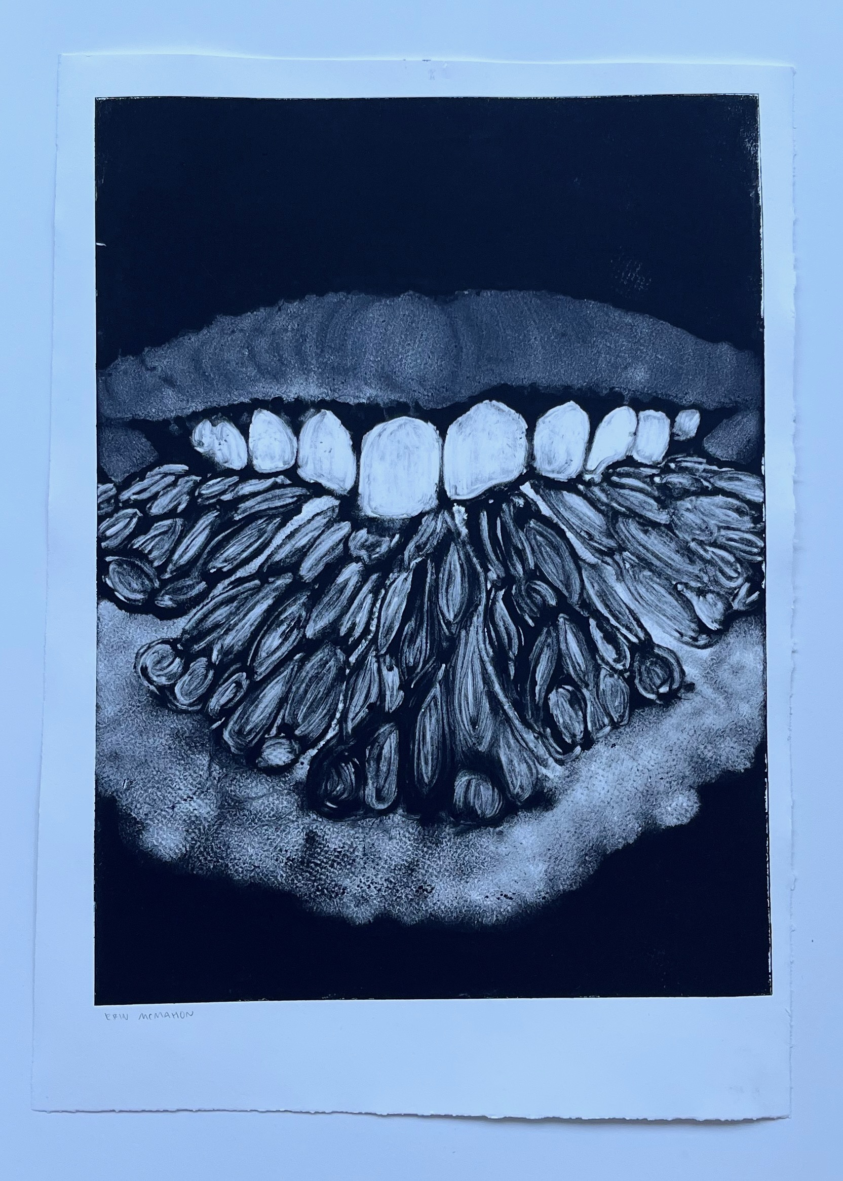 Bite me 1